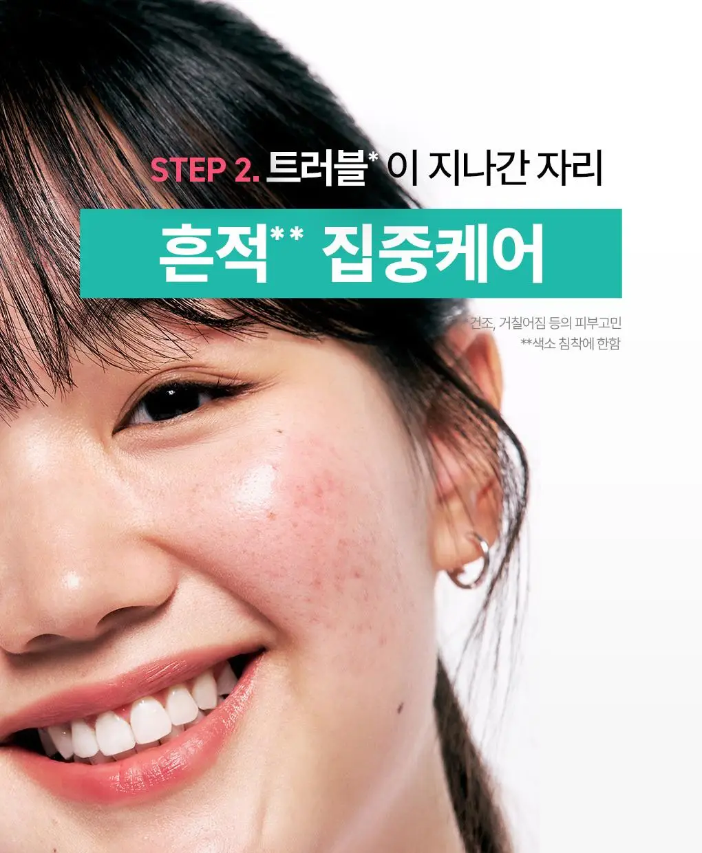 [흔적케어]브링그린 징크테카 리페어 흔적 크림 80ml (콜라보/기획) 상세페이지 28